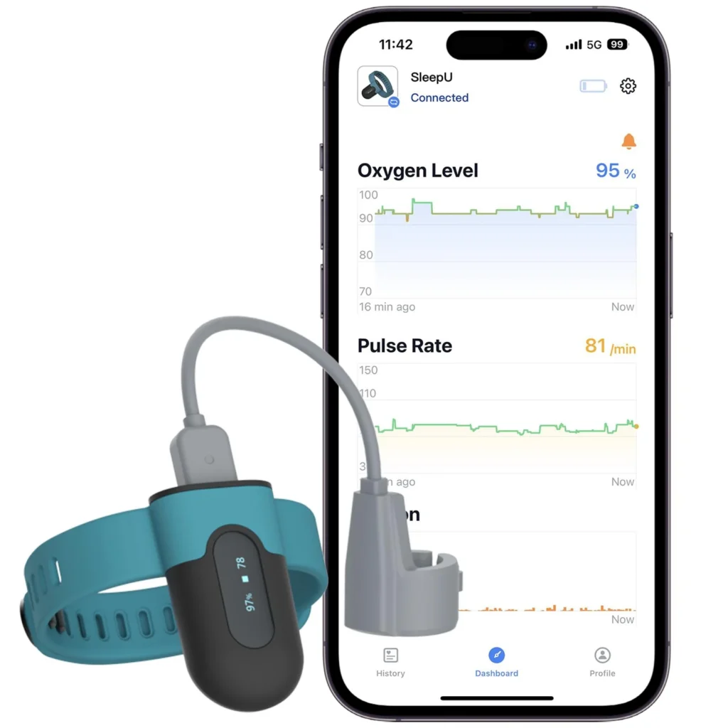 Wellue O2Ring wearable oxygen monitor with mobile app tracking