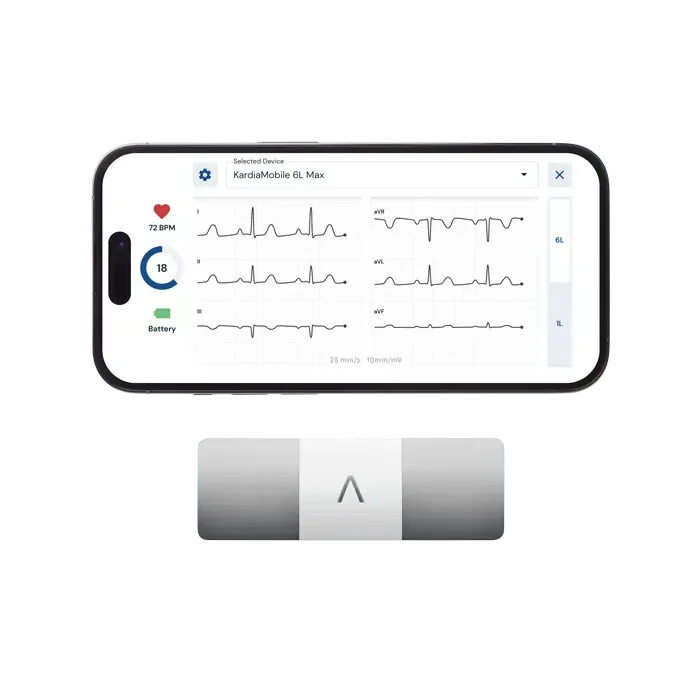 KardiaMobile 6L sensor and smartphone app displaying six ECG leads and real-time heart rate.
