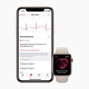 Apple Watch Ultra 2 ECG feature shown alongside an iPhone Health app screen displaying an electrocardiogram waveform and heart rhythm result.