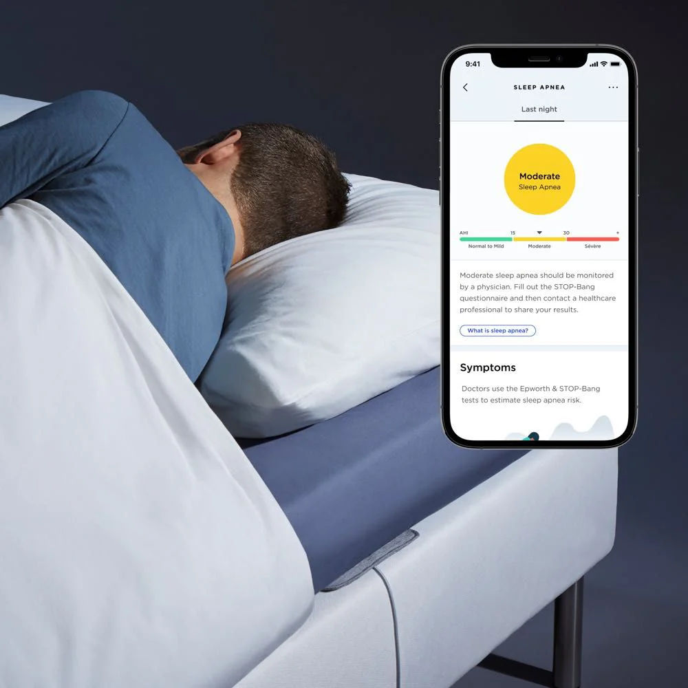 Bedside sleep monitor tracking breathing patterns and sleep apnea risk without body contact