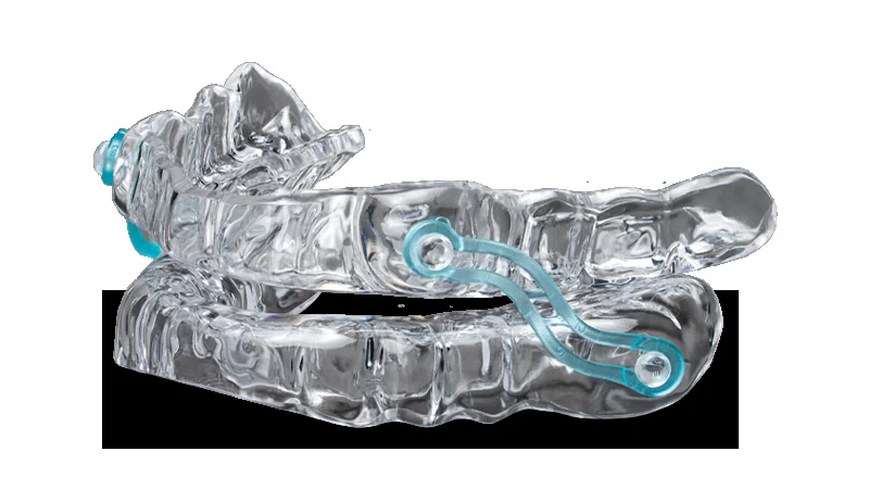 Mandibular advancement oral appliance used to treat snoring and obstructive sleep apnea